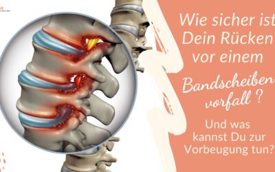 Wie sicher ist Dein Rücken vor einem Bandscheibenvorfall? Und was kannst Du zur Vorbeugung tun?